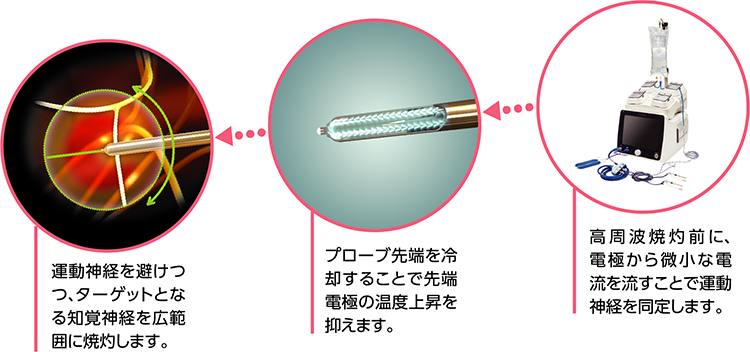 クーリーフのシステム
